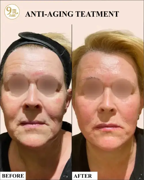 anti_aging_1