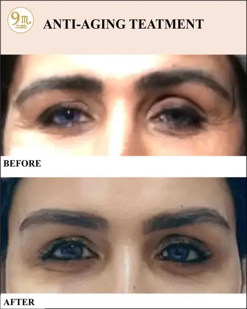 anti_aging_3