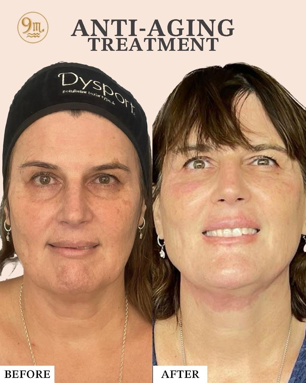 after-before-treatment