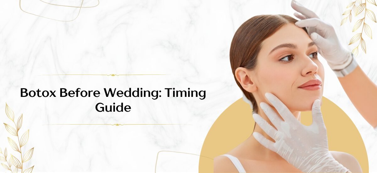 Botox Before Your Wedding: The Perfect Timing Guide for Brides