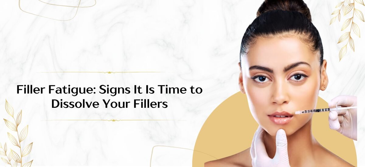 Filler Fatigue: Signs It Is Time to Dissolve Your Fillers